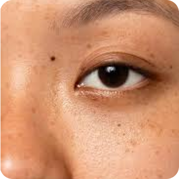 Eye Care